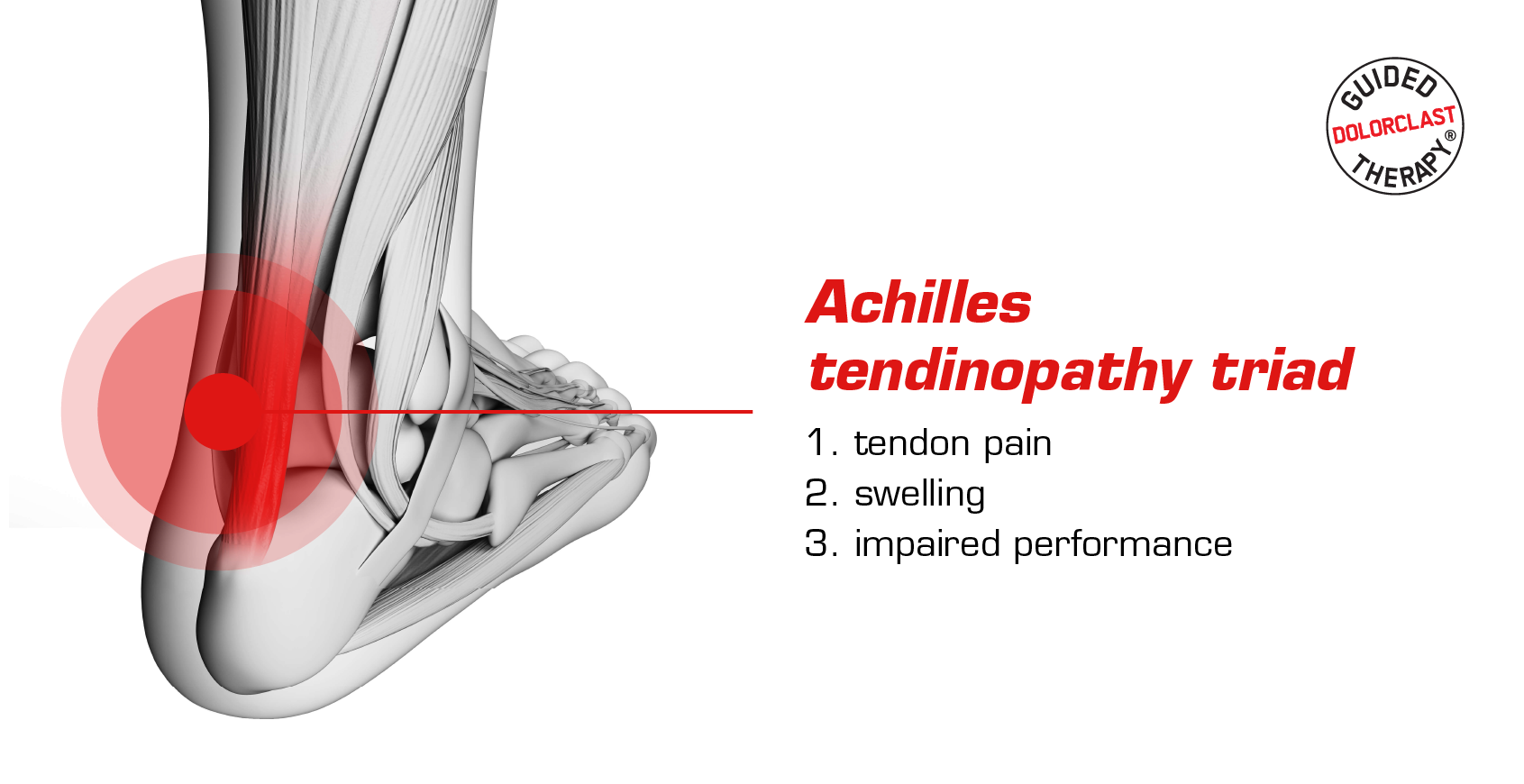 achilles tendinopathy banner 2