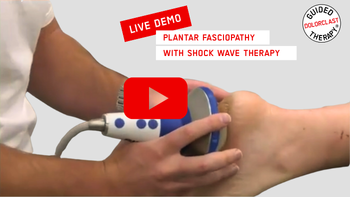 plantar fasciopathy live treatment