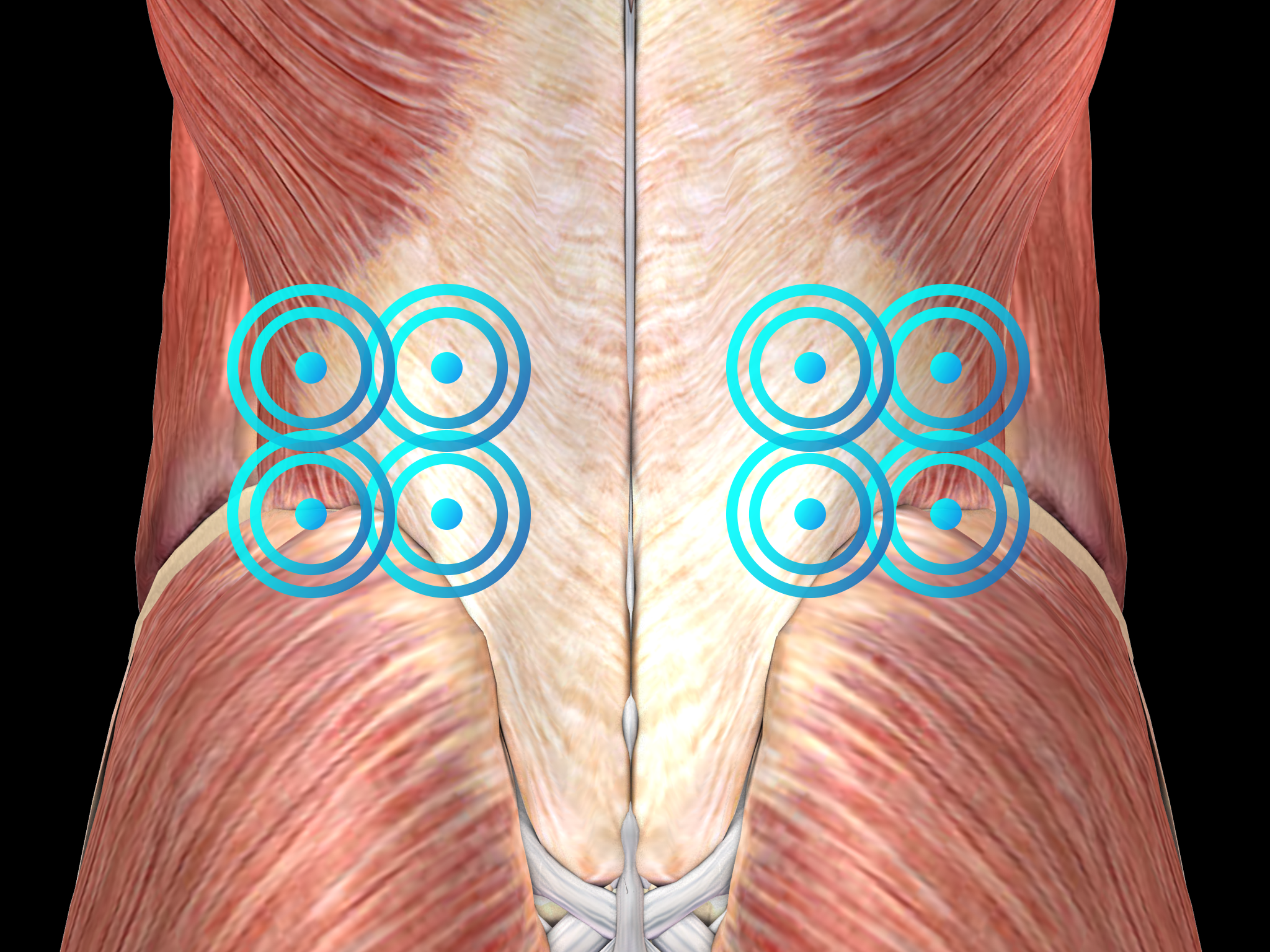 Back area. Pain in the Lumbar Region. The Kidney is under the lower Lumbar Spine.