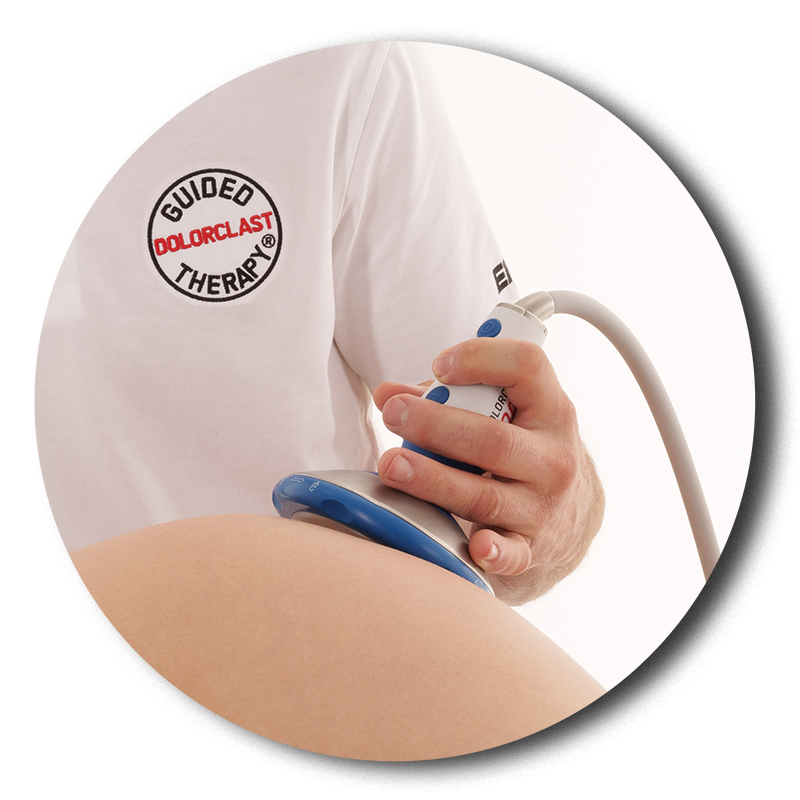 dolorclast focused shock waves round