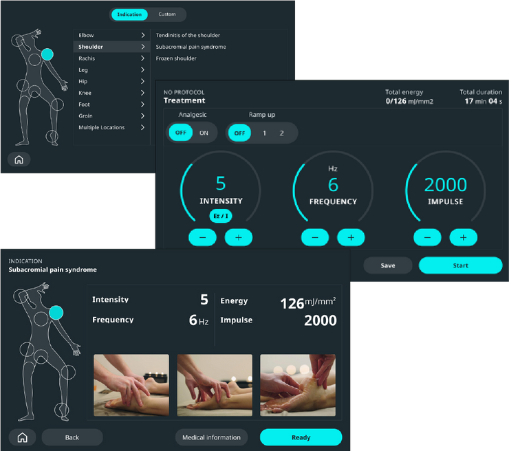 modes focused shock waves