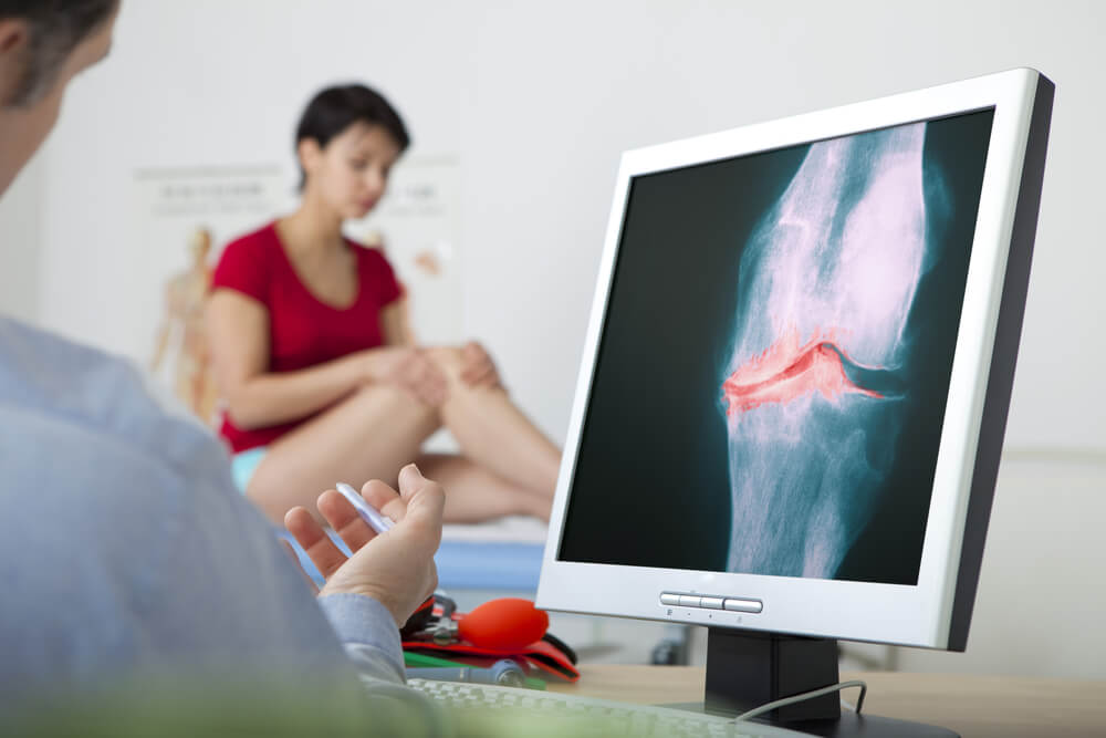 knee osteoarthritis initial assessment