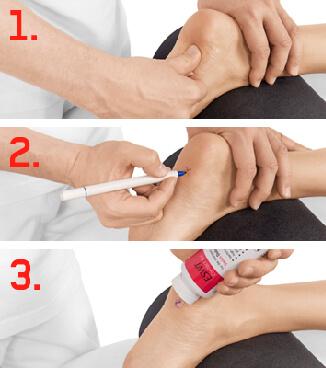 dolorclast method 3 first steps