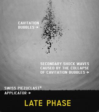 Late phase