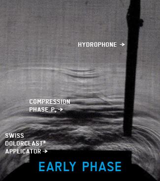 Visualization of Early Phase radial shock wave energy