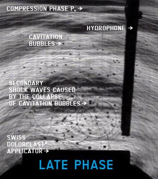 Visualization of late Phase radial shock wave energy